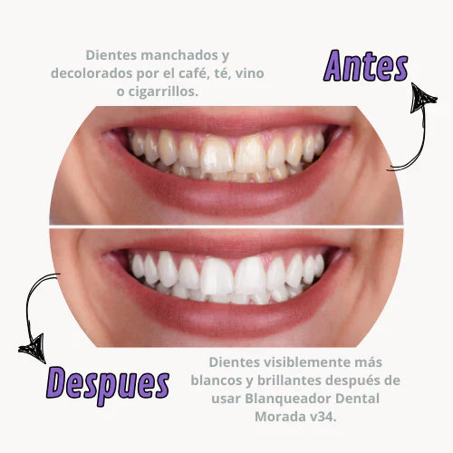 Sonríe al instante: V34, el efecto visual que neutraliza tonos amarillos sin peróxido