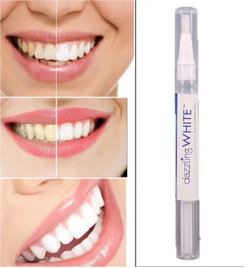 SonrisaFlash™ Sonrisa más blanca en solo minutos con nuestro Lápiz Blanqueador 2x1