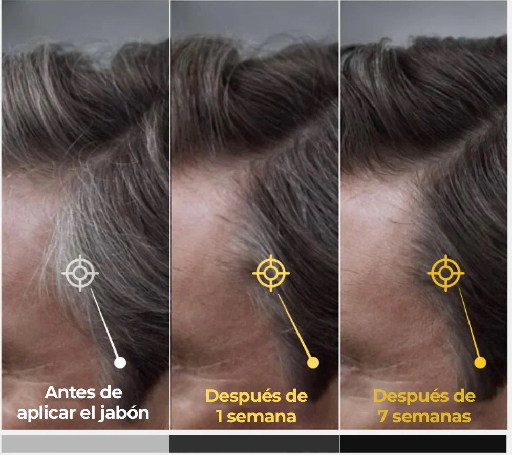 “Jabón Anticanas Buny™  Recupera tu tono natural”