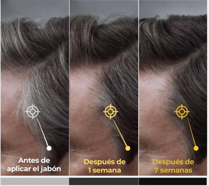 “Jabón Anticanas Buny™  Recupera tu tono natural”