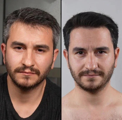 “Jabón Anticanas Buny™  Recupera tu tono natural”
