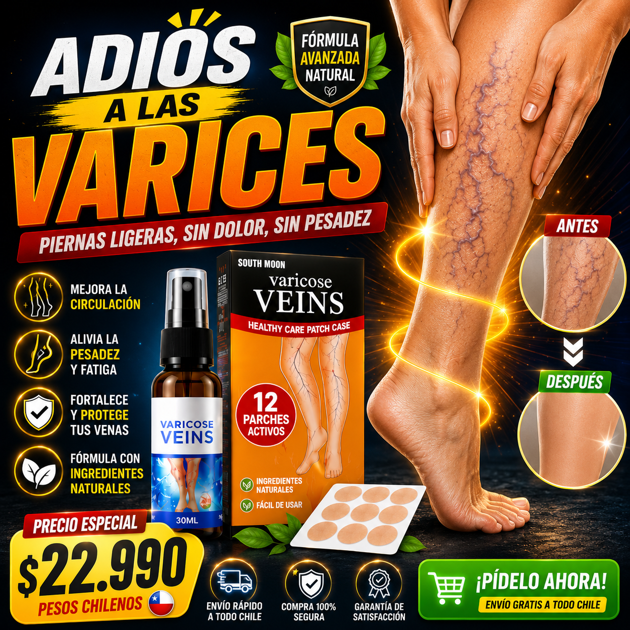 KIT VARICES SPRAY + 12 PARCH